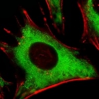 RPLP0P6 Rabbit Polyclonal Antibody