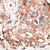 Anti-TPX2 Antibody