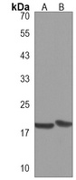 FAM159A Rabbit Polyclonal Antibody