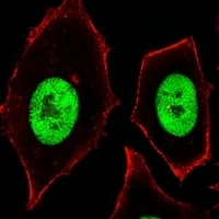 Anti-ZSCAN32 Antibody