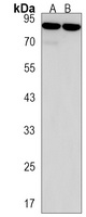 Semaphorin 6B Rabbit Polyclonal Antibody