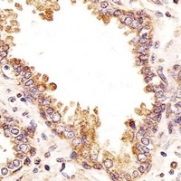 Anti-ZRSR2 Antibody
