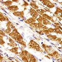 Anti-MORC3 Antibody