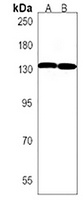 ANKS1A Rabbit Polyclonal Antibody