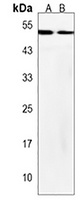 OXCT2 Rabbit Polyclonal Antibody
