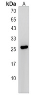 LRRC61 Antibody