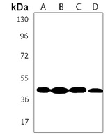 MECR Rabbit Polyclonal Antibody
