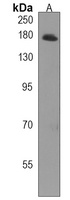 MAST1 Rabbit Polyclonal Antibody