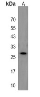 PIH1D3 Antibody