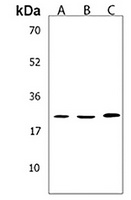 TMEM199 Rabbit Polyclonal Antibody