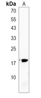 SPANXB Rabbit Polyclonal Antibody