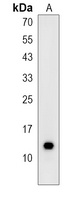 SH3BGRL1 Rabbit Polyclonal Antibody