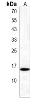 CYYR1 Antibody