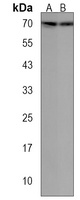 PIGB Rabbit Polyclonal Antibody
