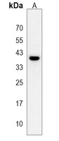 Ephrin B1 Rabbit Polyclonal Antibody