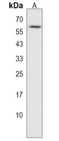 ZNF394 Rabbit Polyclonal Antibody