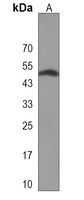 CASQ2 Antibody