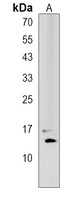 HIST2H2AC Rabbit Polyclonal Antibody