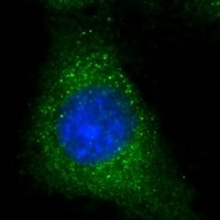 Anti-PRSS57 Antibody