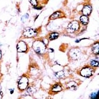 ZNF395 Antibody