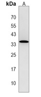 OR6S1 Rabbit Polyclonal Antibody