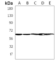 ZNF654 Rabbit Polyclonal Antibody