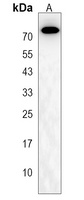AGAP11 Rabbit Polyclonal Antibody