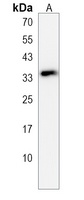 RAET1E Antibody