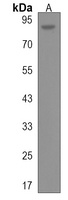 ZNF337 Rabbit Polyclonal Antibody
