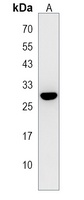 VGLL4 Rabbit Polyclonal Antibody
