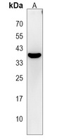 TOPK Rabbit Polyclonal Antibody