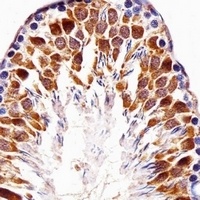TOPK Rabbit Polyclonal Antibody