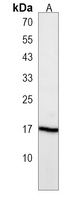 RPL13A Rabbit Polyclonal Antibody