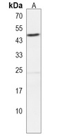 Septin 12 Rabbit Polyclonal Antibody