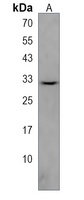 ZNF783 Rabbit Polyclonal Antibody