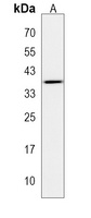 RRN3P2 Rabbit Polyclonal Antibody