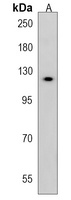 WDR64 Rabbit Polyclonal Antibody