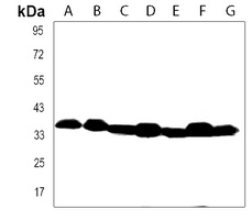 GATSL2 Rabbit Polyclonal Antibody