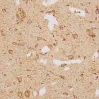 GATSL2 Rabbit Polyclonal Antibody