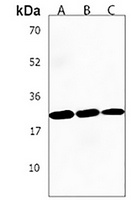 STAG3L1 Rabbit Polyclonal Antibody