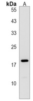 RPS17L Rabbit Polyclonal Antibody