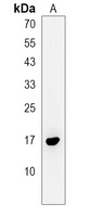 PAPPA-AS1 Rabbit Polyclonal Antibody
