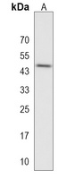 RUNDC3A Rabbit Polyclonal Antibody