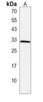OR10T2 Rabbit Polyclonal Antibody