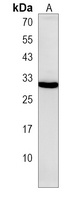 RAB22 Rabbit Polyclonal Antibody