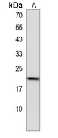 PMS2P5 Rabbit Polyclonal Antibody