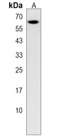 GMCL1P1 Rabbit Polyclonal Antibody