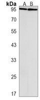 TCHHL1 Antibody