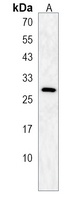CTRL Rabbit Polyclonal Antibody