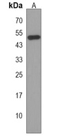 TBC1D20 Rabbit Polyclonal Antibody